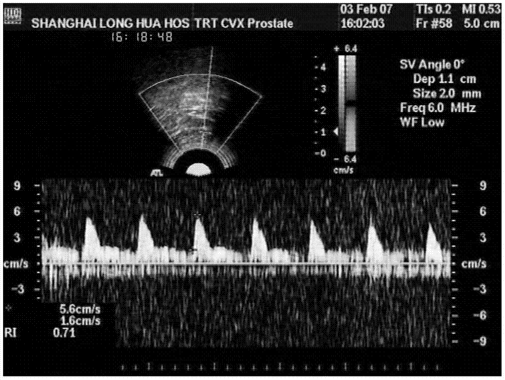 A hip surface measurement and normal pressure diagnosis and treatment system