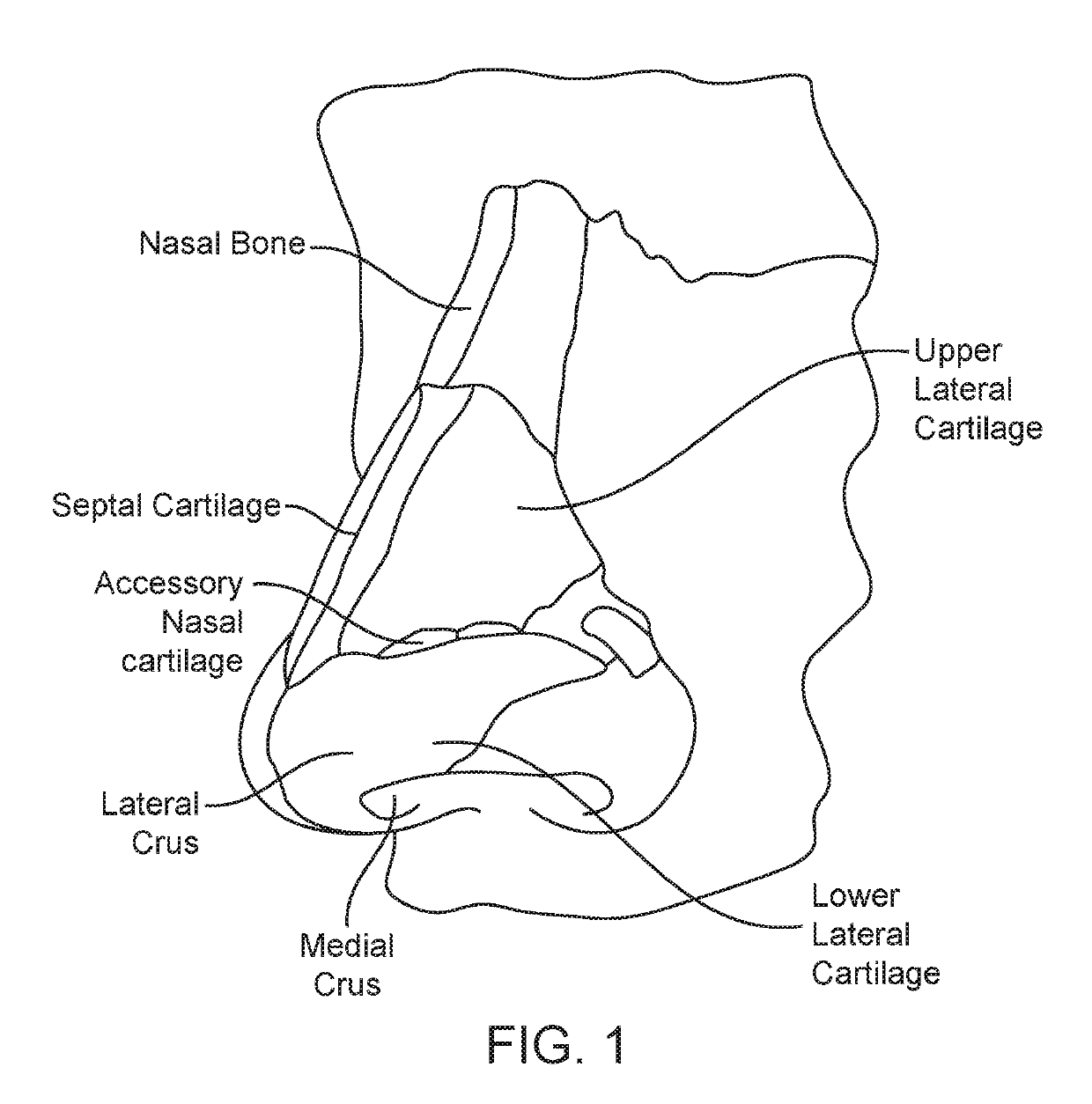 Methods and devices to treat nasal airways