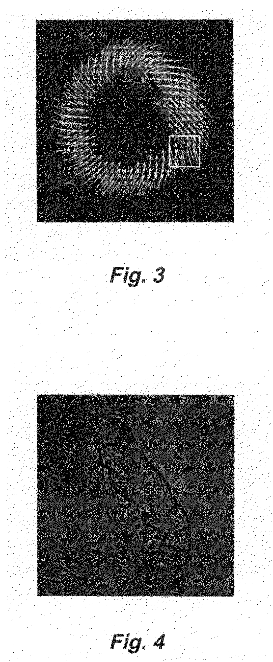 Motion-guided segmentation for cine DENSE images