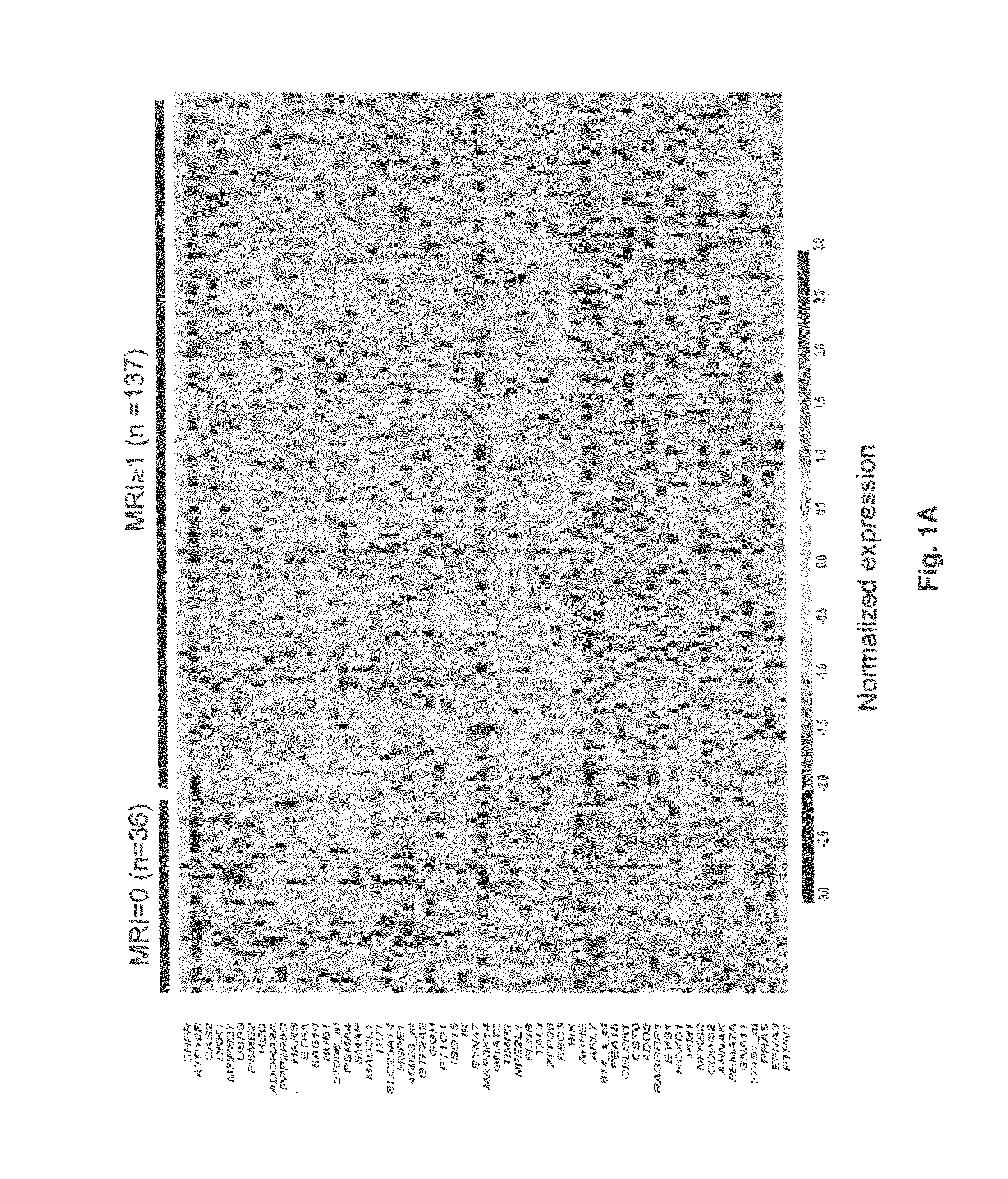 Molecular determinants of myeloma bone disease and use thereof