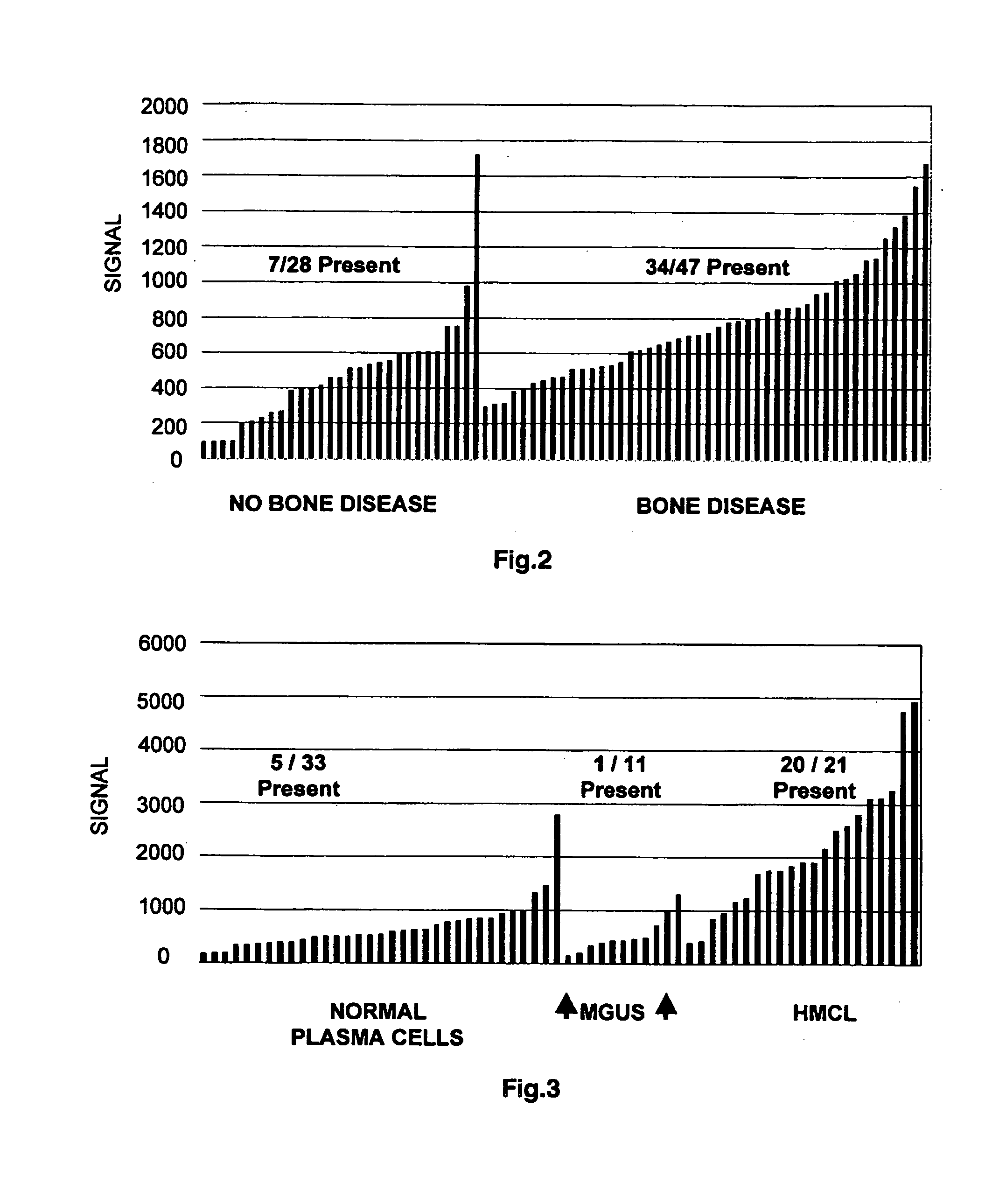 Molecular determinants of myeloma bone disease and use thereof