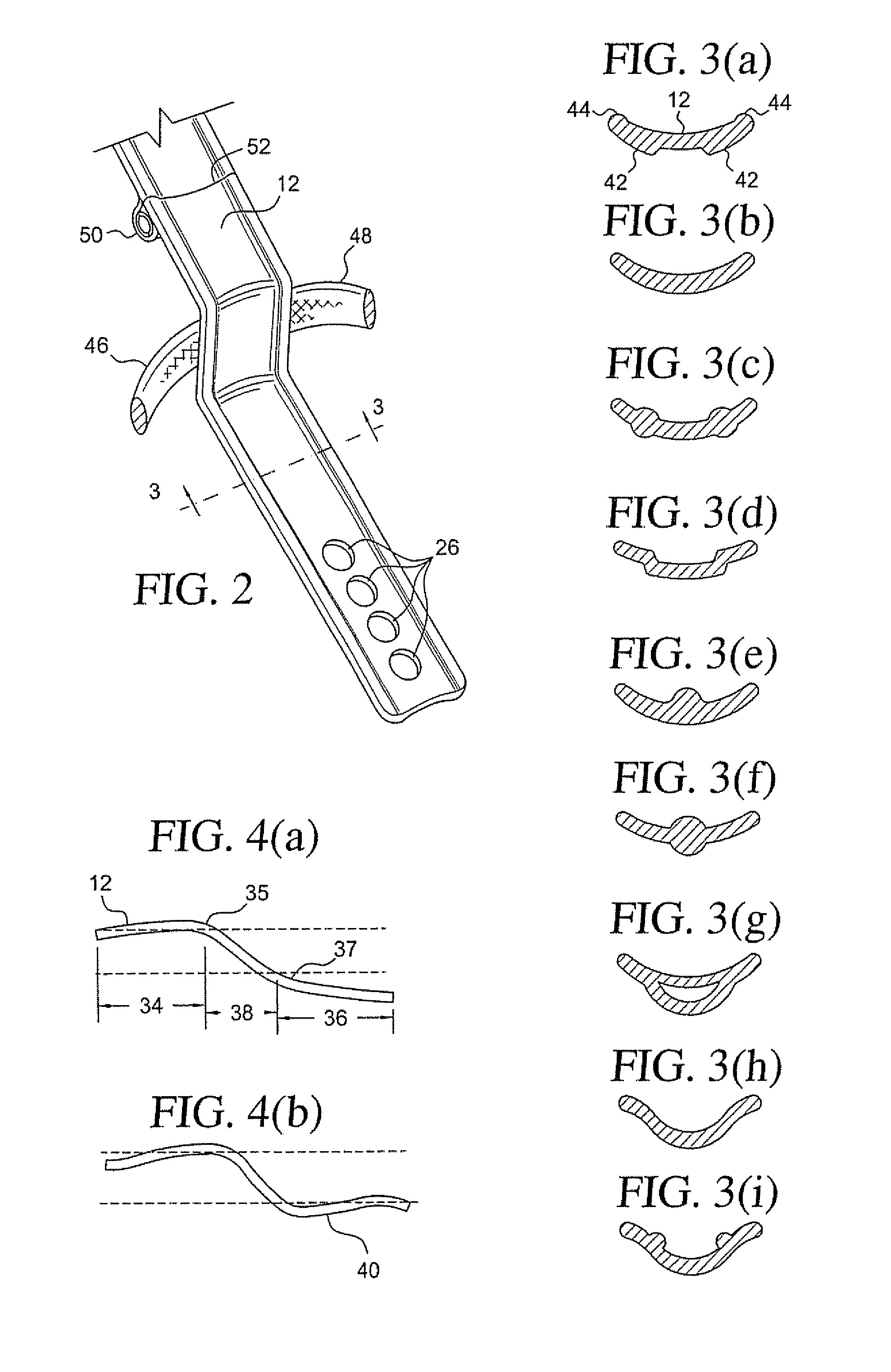 Knee immobilizer