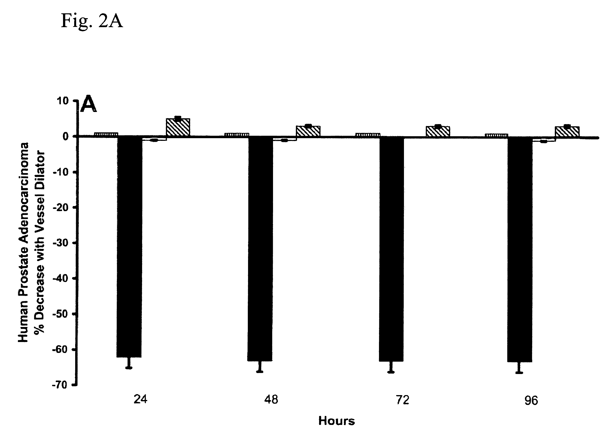 Cancer treatment using C-type natriuretic peptides