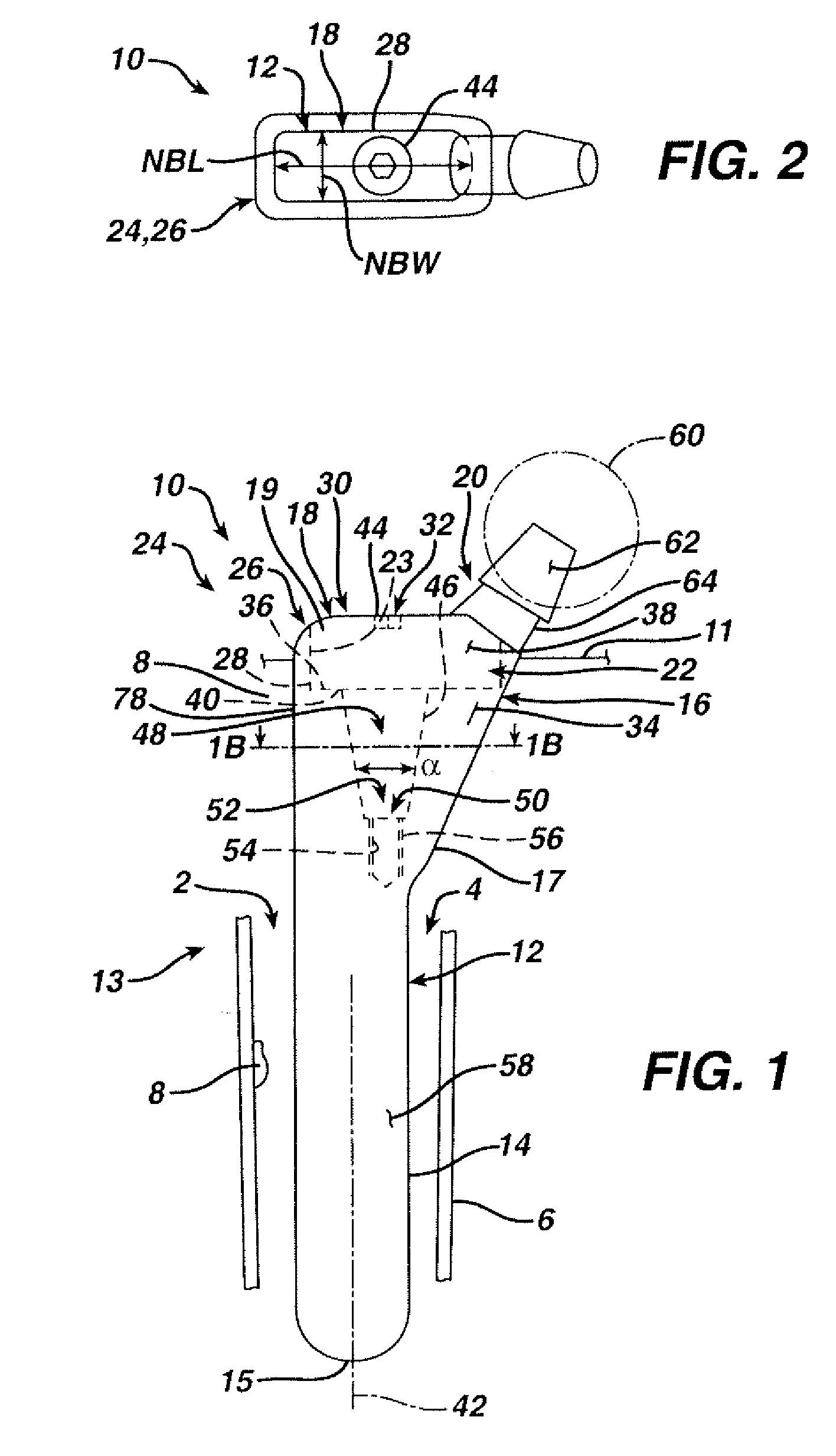 Orthopaedic implant kit, orthopaedic surgery kit and associated method