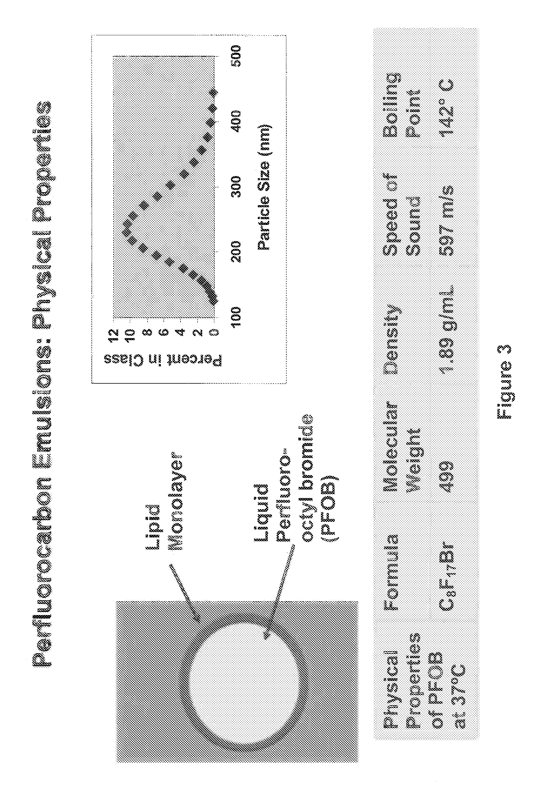 Ultrasonic Characterization of Internal Body Conditions Using Information Theoretic Signal Receivers