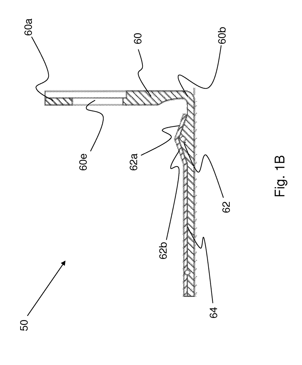 Shoulder rest for a stringed instrument