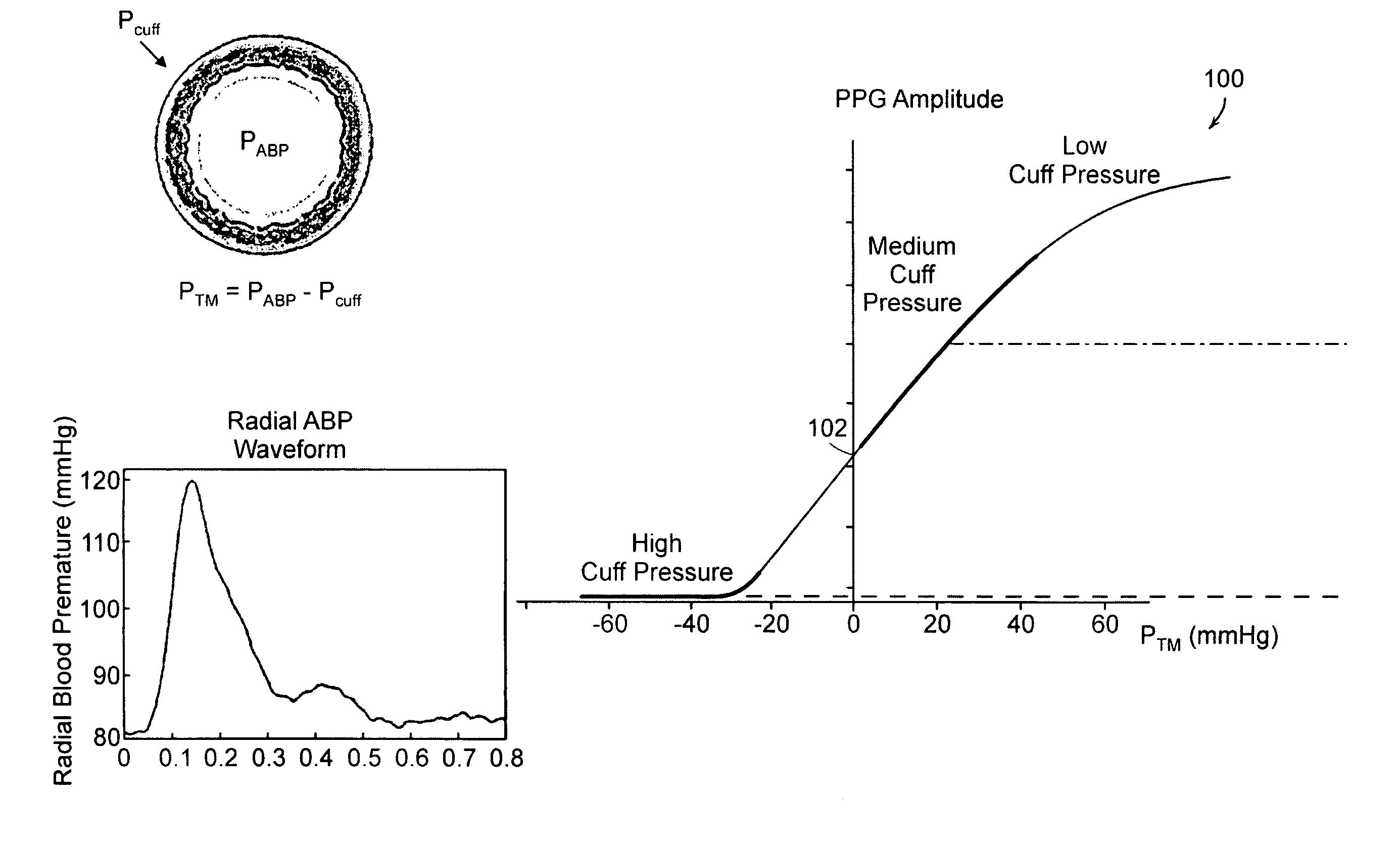 Wearable blood pressure sensor and method of calibration