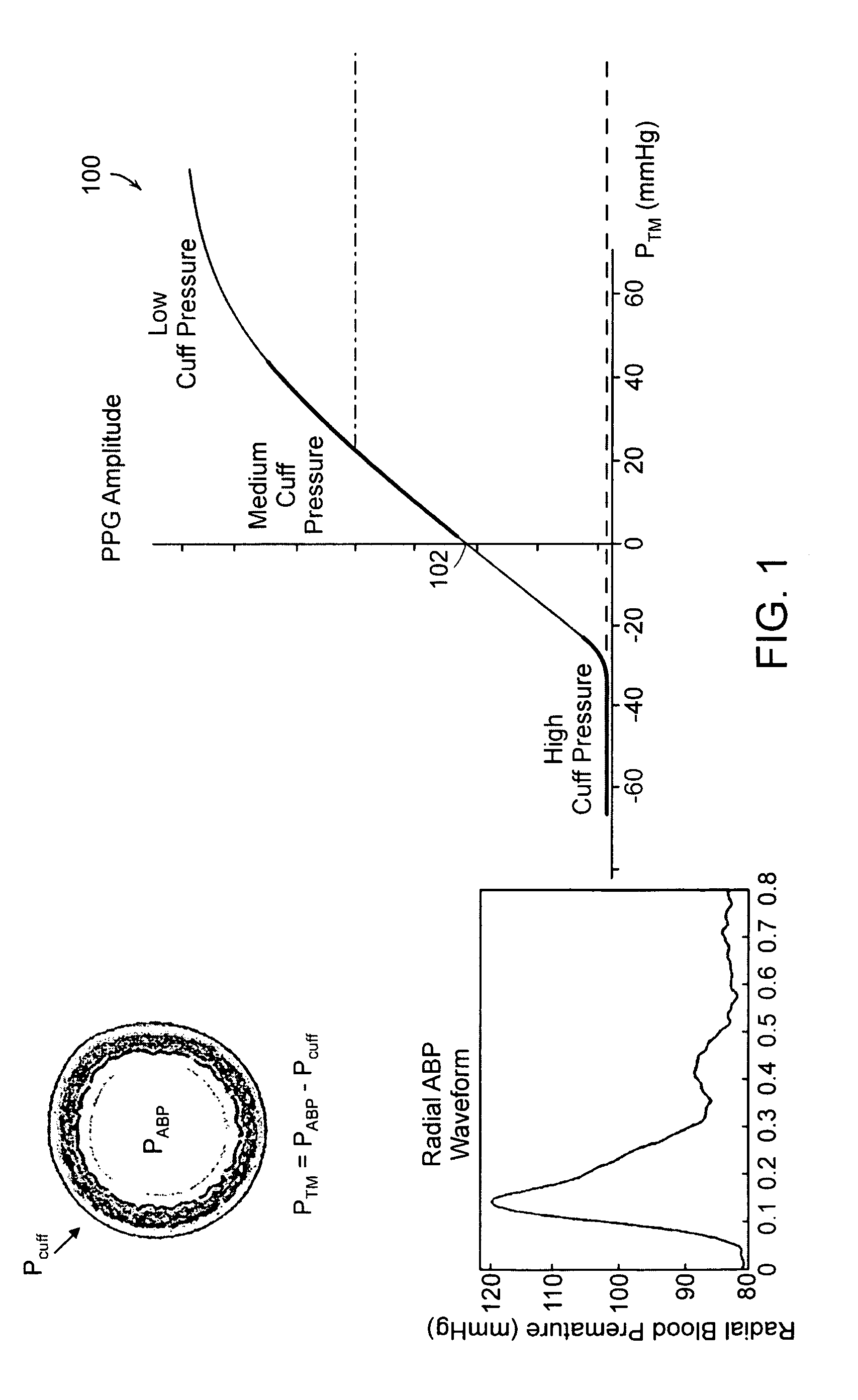 Wearable blood pressure sensor and method of calibration