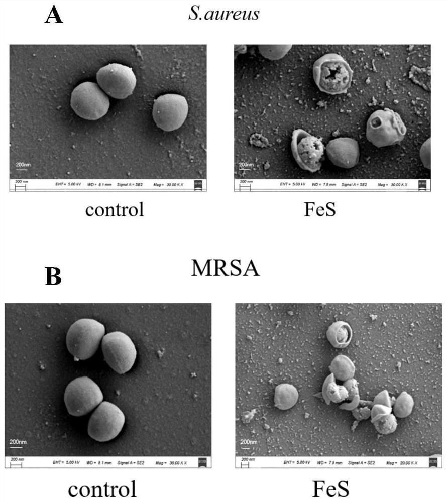 Nano iron sulfide with dual functions of inhibiting bacteria and slowly releasing hydrogen sulfide as well as preparation method and application thereof