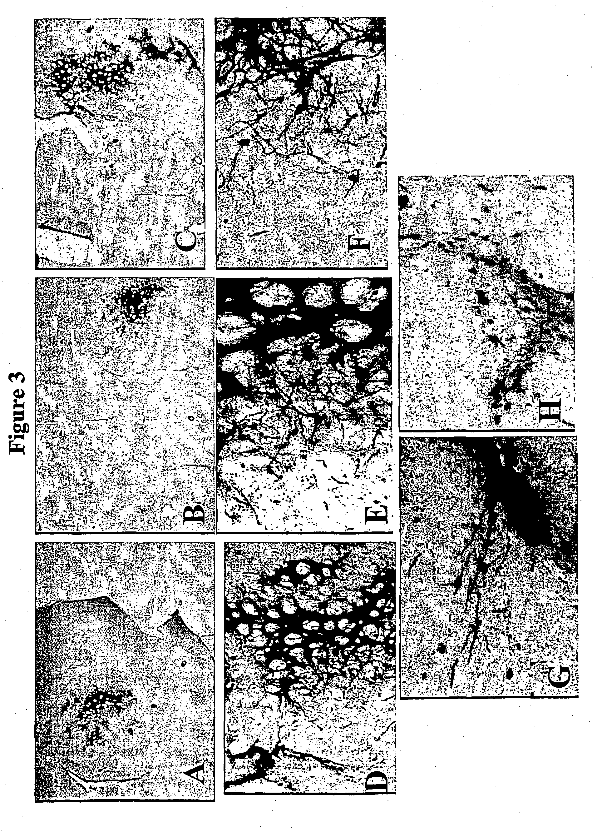 Vector system