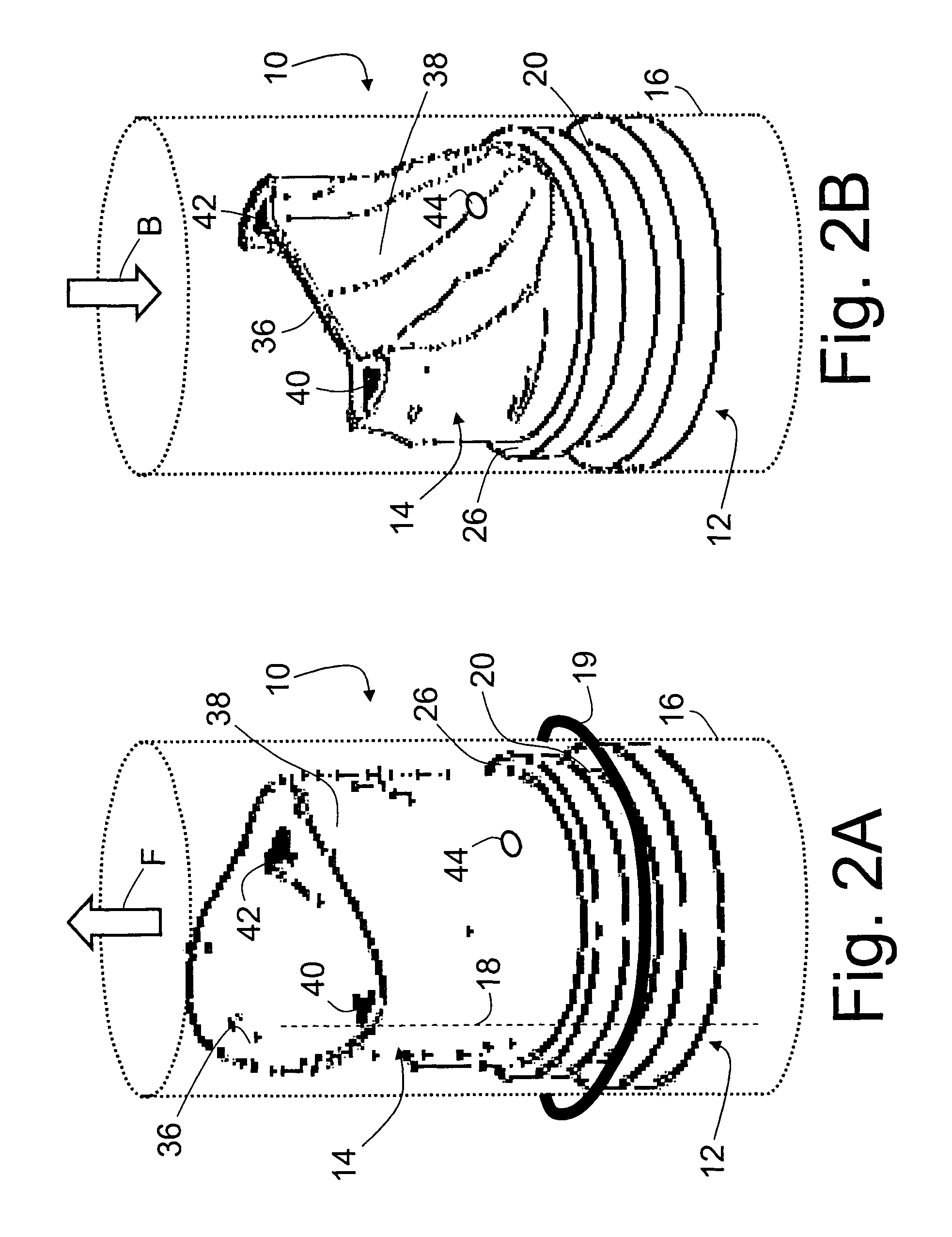 Prosthetic venous valves