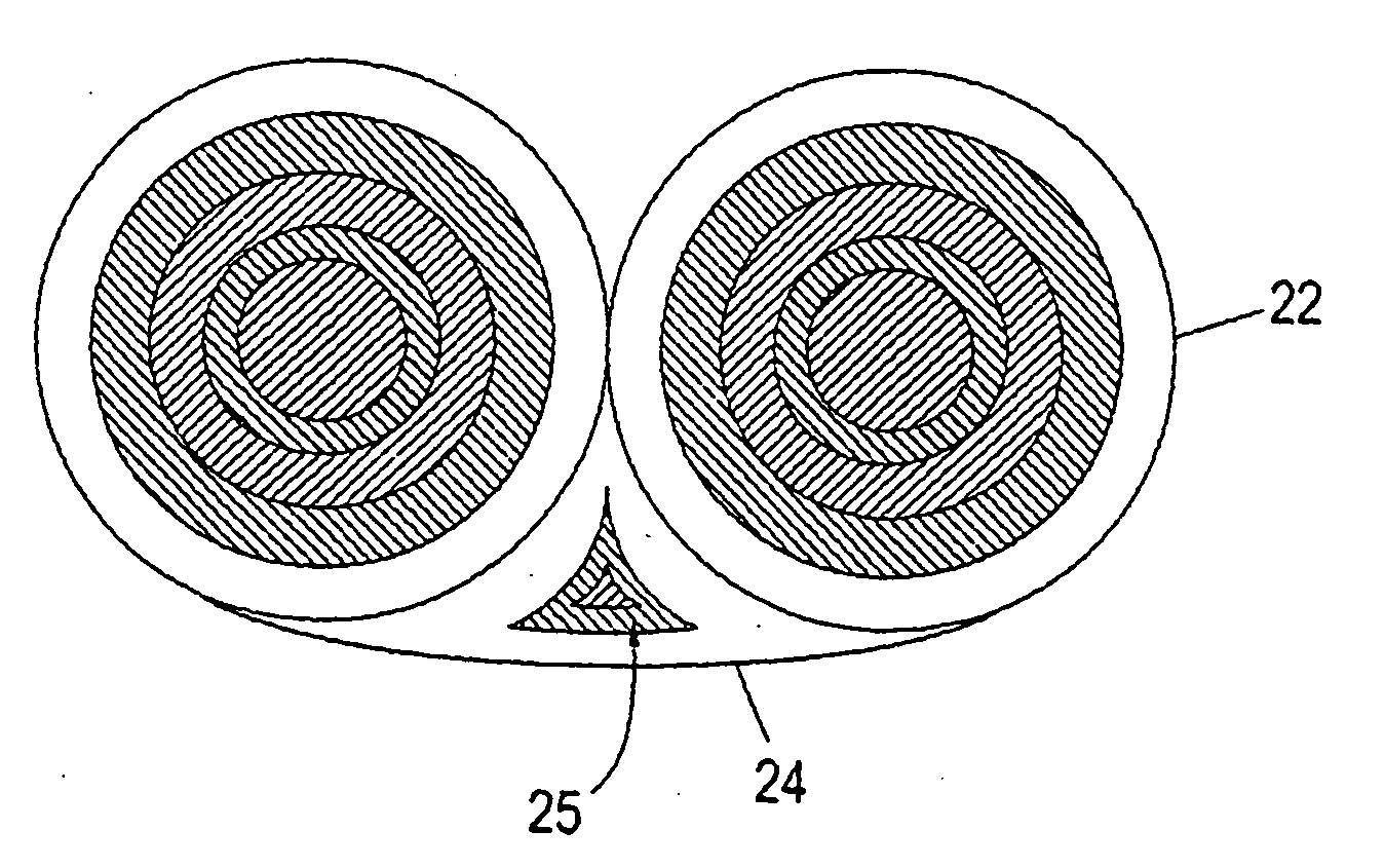 Method and apparatus for treating renal disease with hemodialysis utilizing pulsatile pump