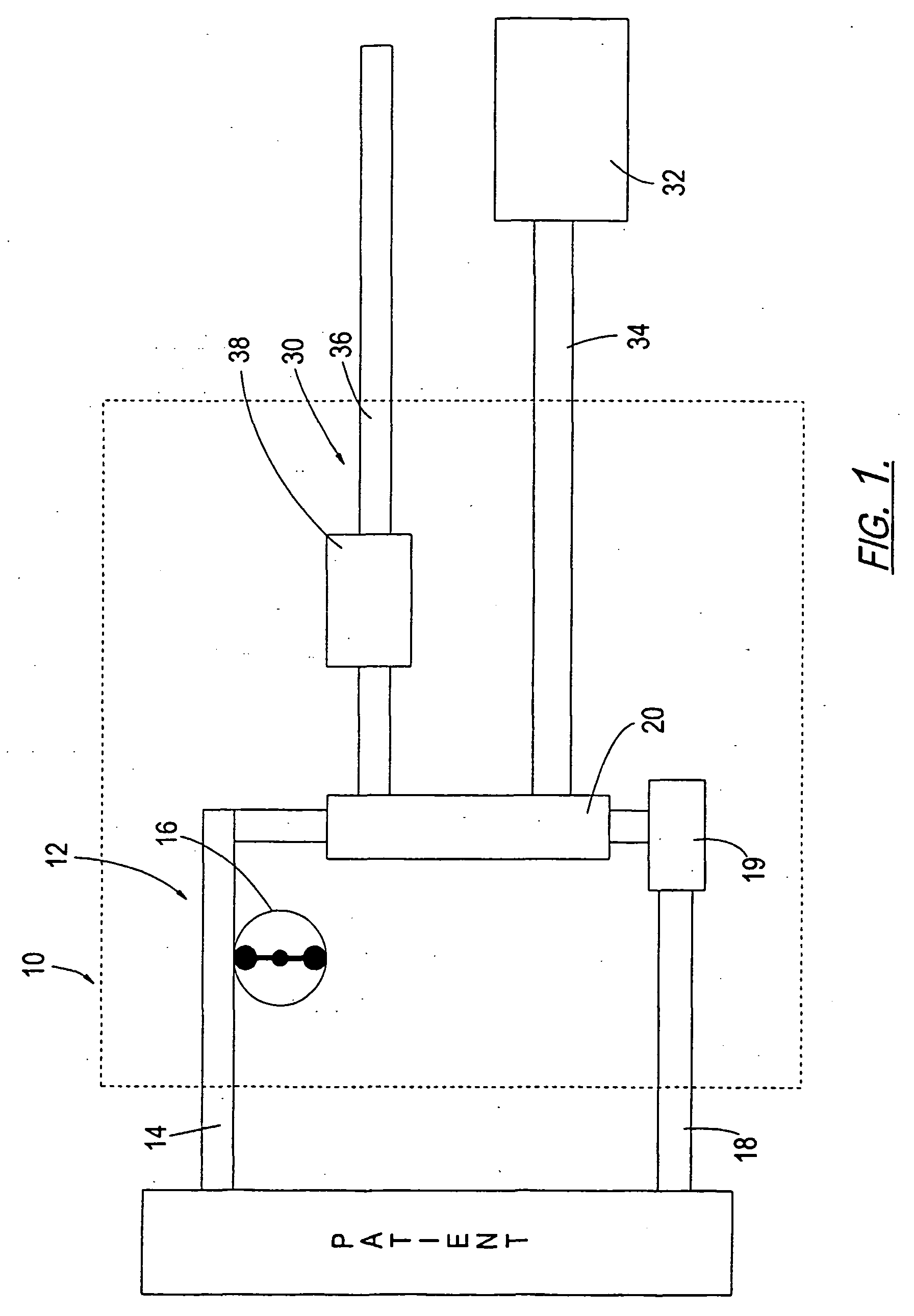 Method and apparatus for treating renal disease with hemodialysis utilizing pulsatile pump