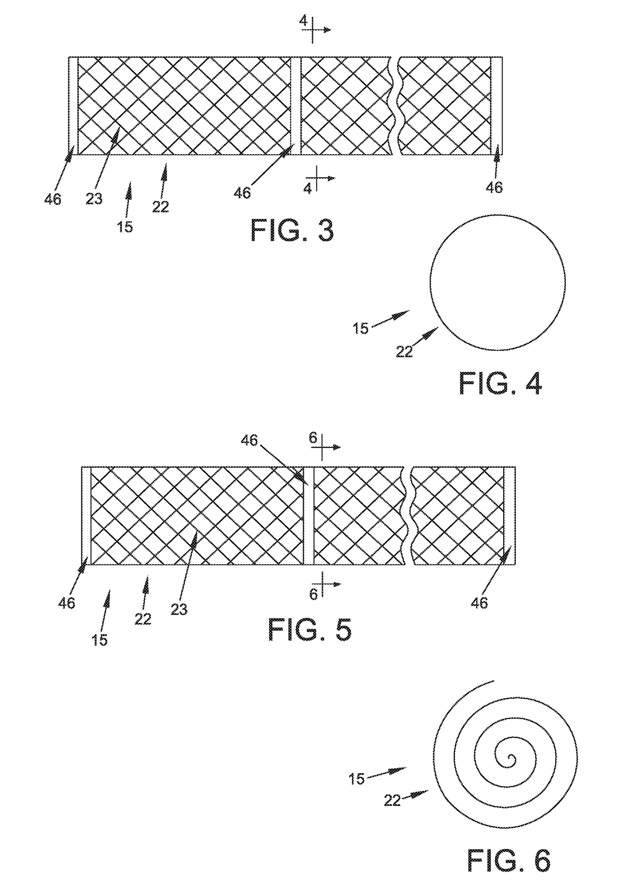 Method and apparatus for treating bone fractures, and/or for fortifying and/or augmenting bone, including the provision and use of composite implants