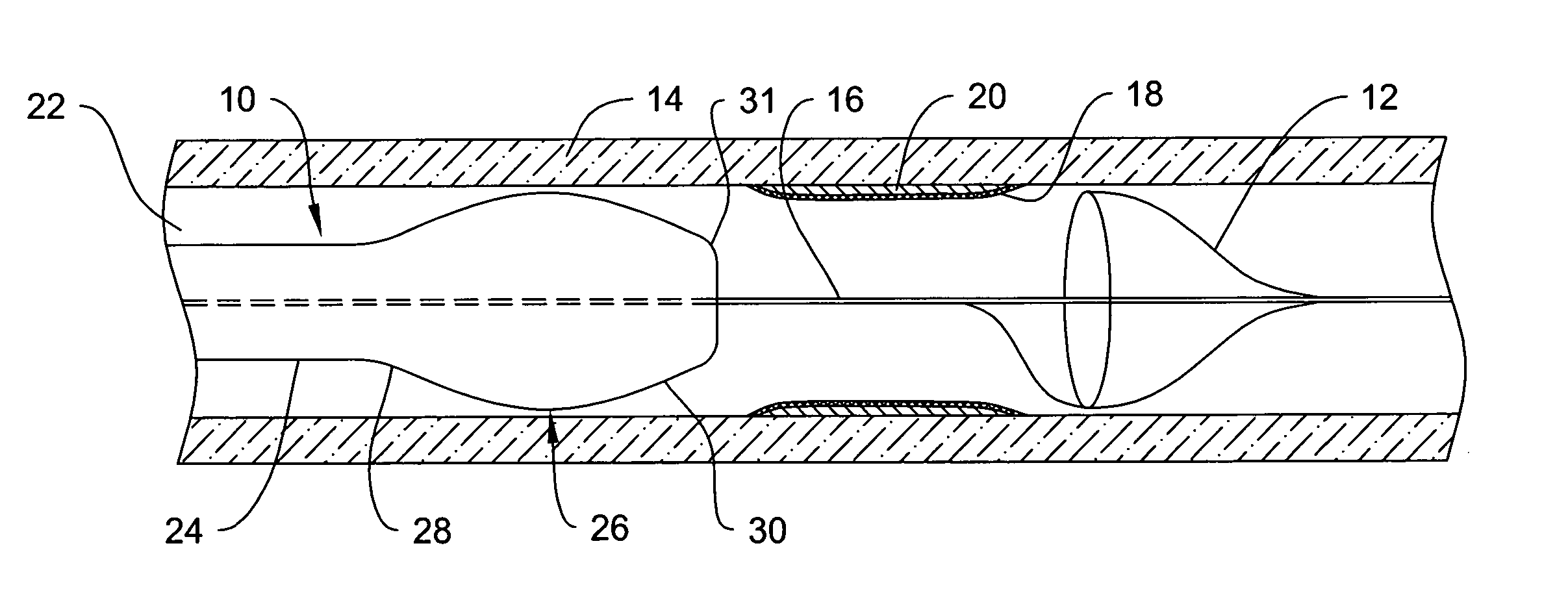 Sheath for use with an embolic protection filtering device