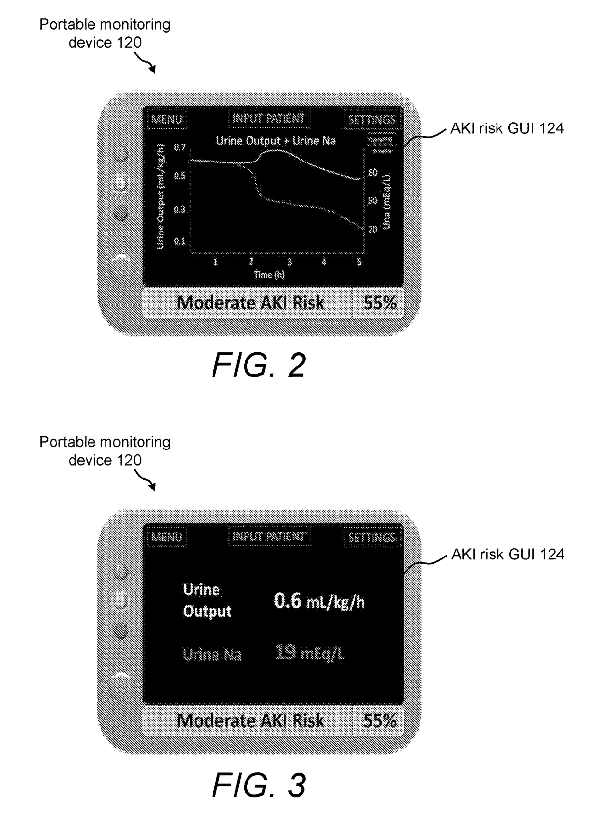 System and urine sensing devices for and method of monitoring kidney function