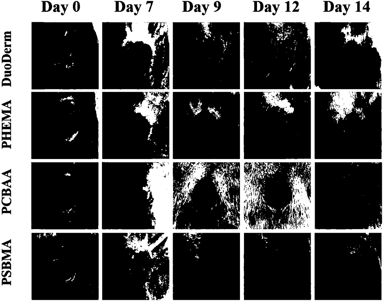 A kind of preparation method and application of zwitterionic hydrogel dressing