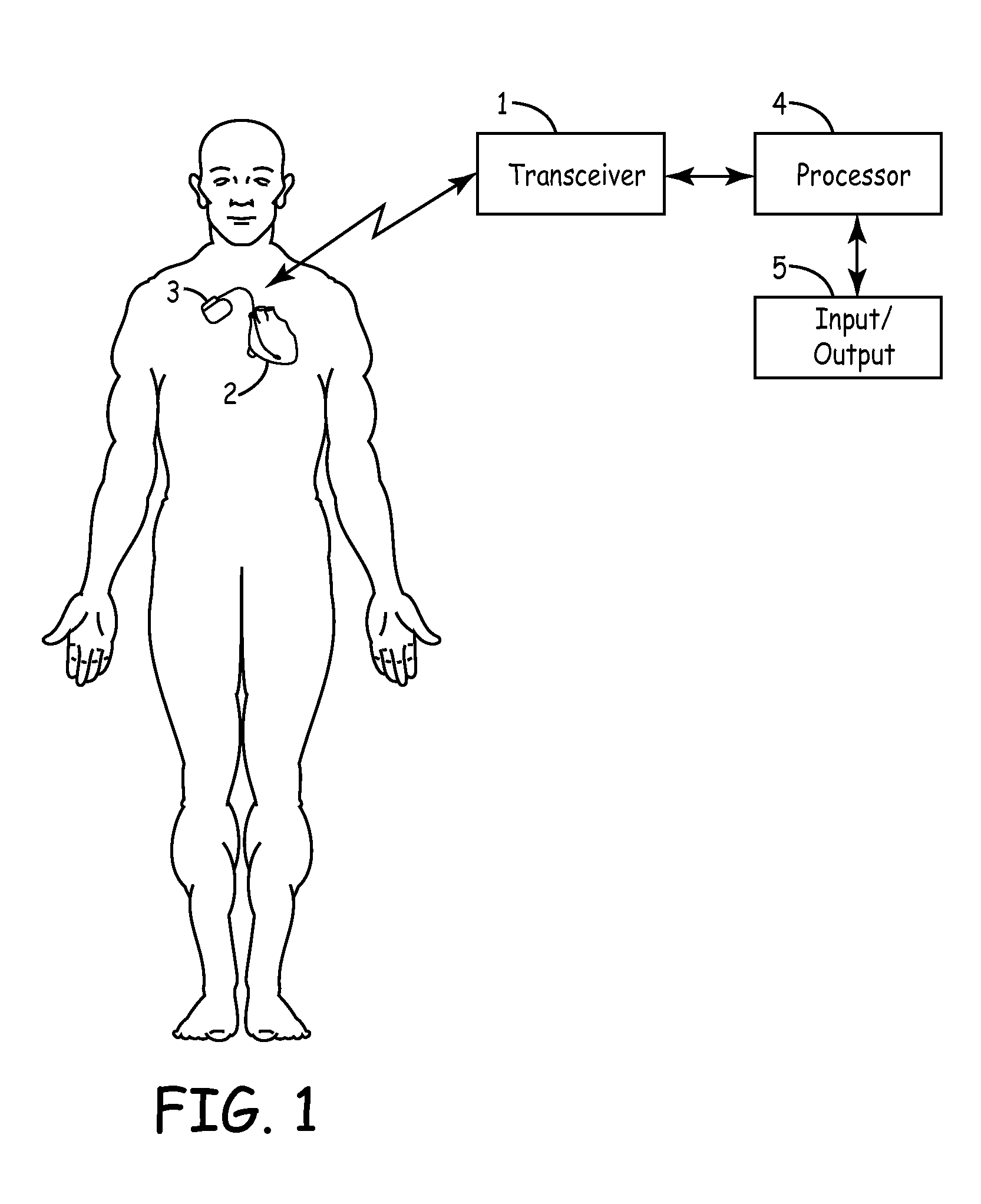 Closed loop optimization of a-v and v-v timing