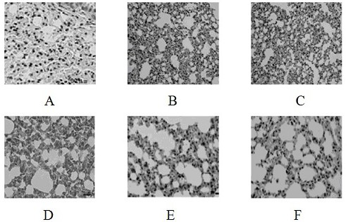 Application of pharmaceutical compositions containing mesenchymal stem cell exosomes in the treatment of diseases