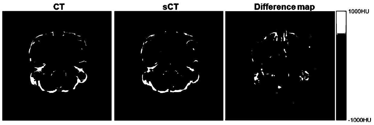 Pseudo CT synthesis method and application based on deep convolutional neural network