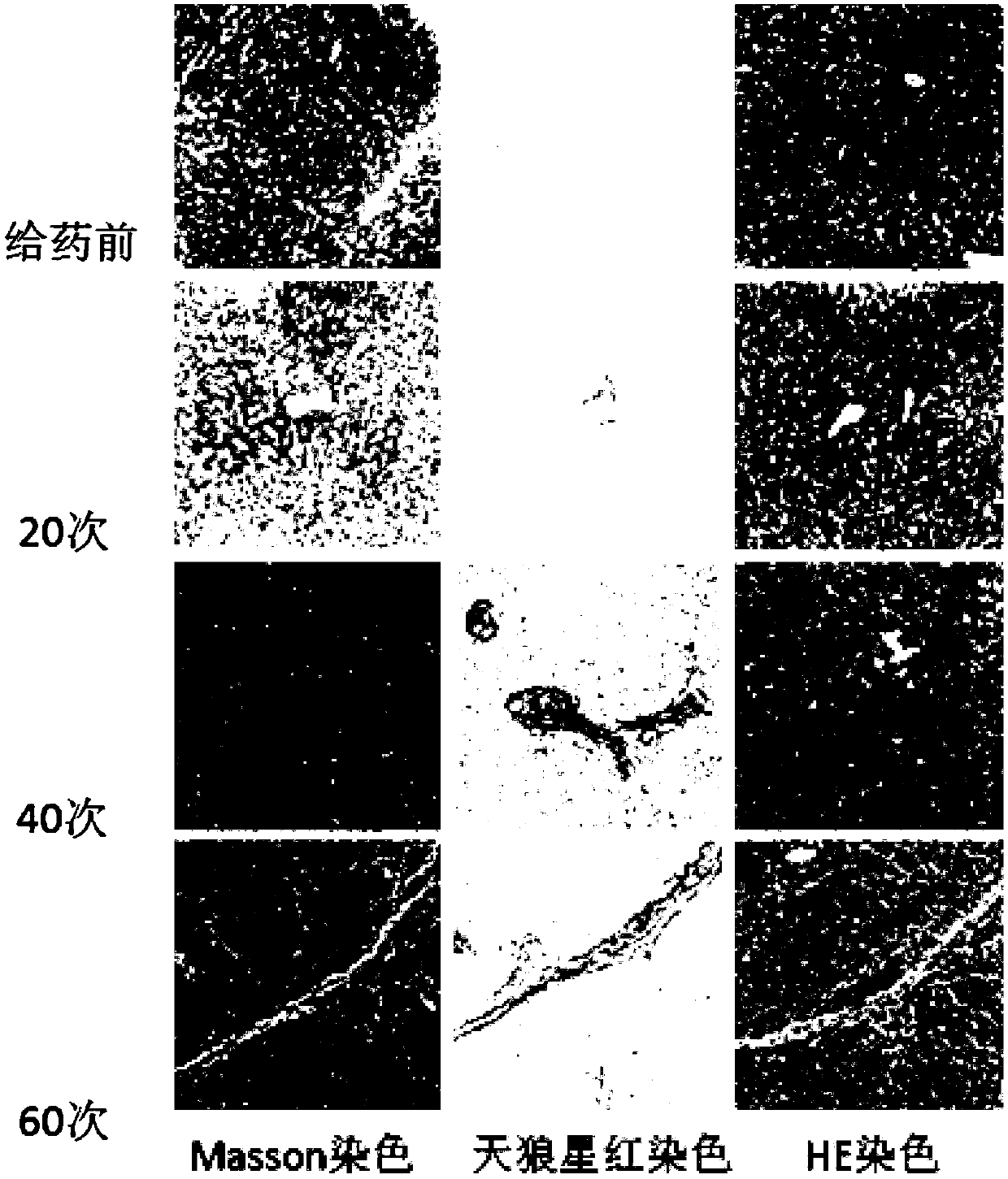 Method for establishment of macaca mulatta liver fibrosis model by intraperitoneal injection