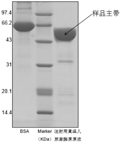 A method for determining the electrophoretic purity of recombinant human prourokinase for injection