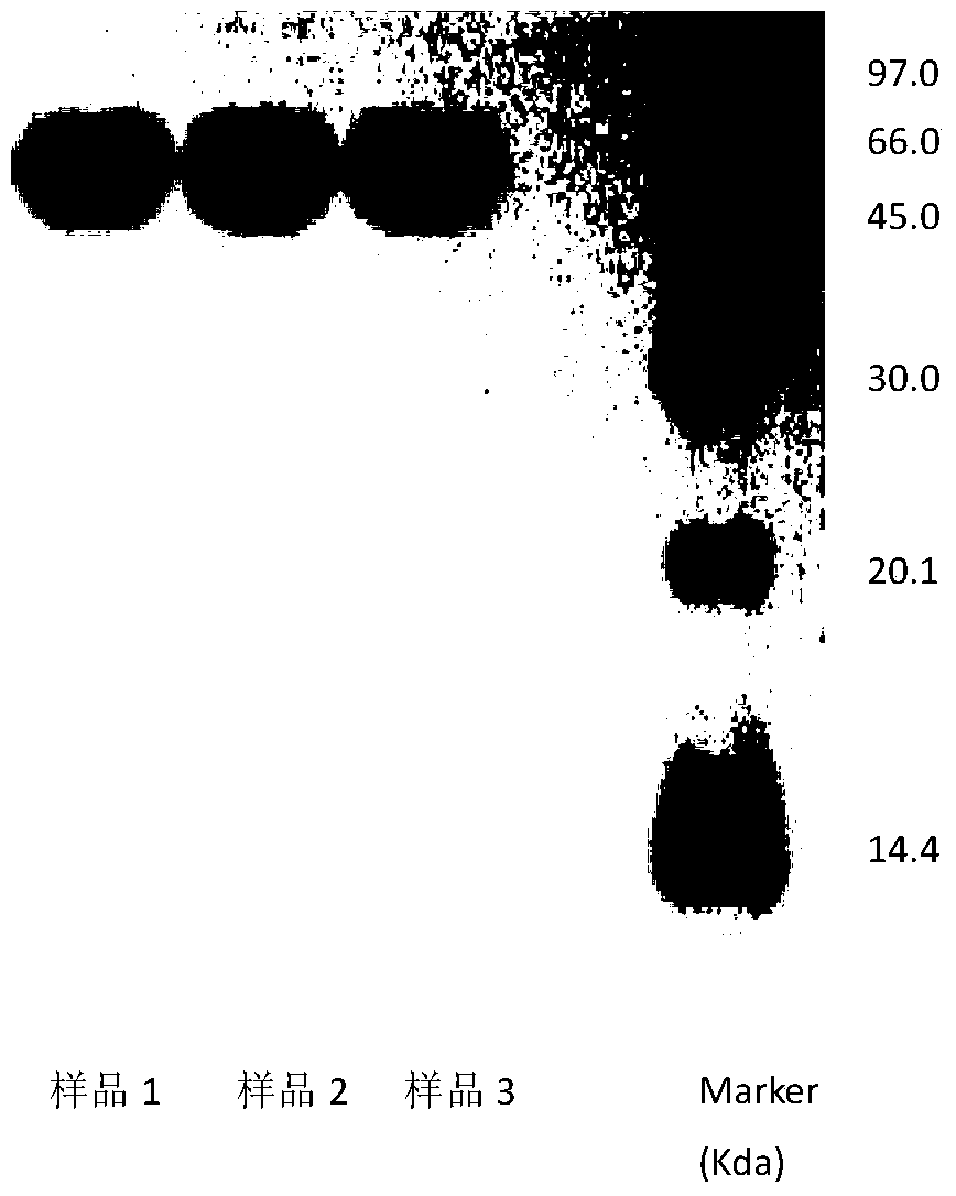 A method for determining the electrophoretic purity of recombinant human prourokinase for injection