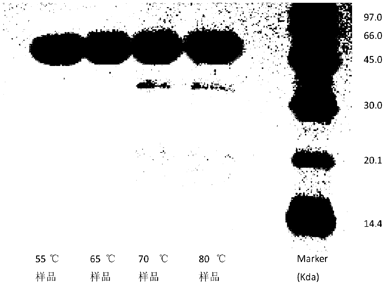 A method for determining the electrophoretic purity of recombinant human prourokinase for injection