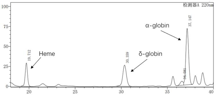 Application of lentiviral vector in preparation of medicine for treating beta-thalassemia