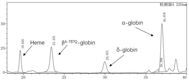 Application of lentiviral vector in preparation of medicine for treating beta-thalassemia