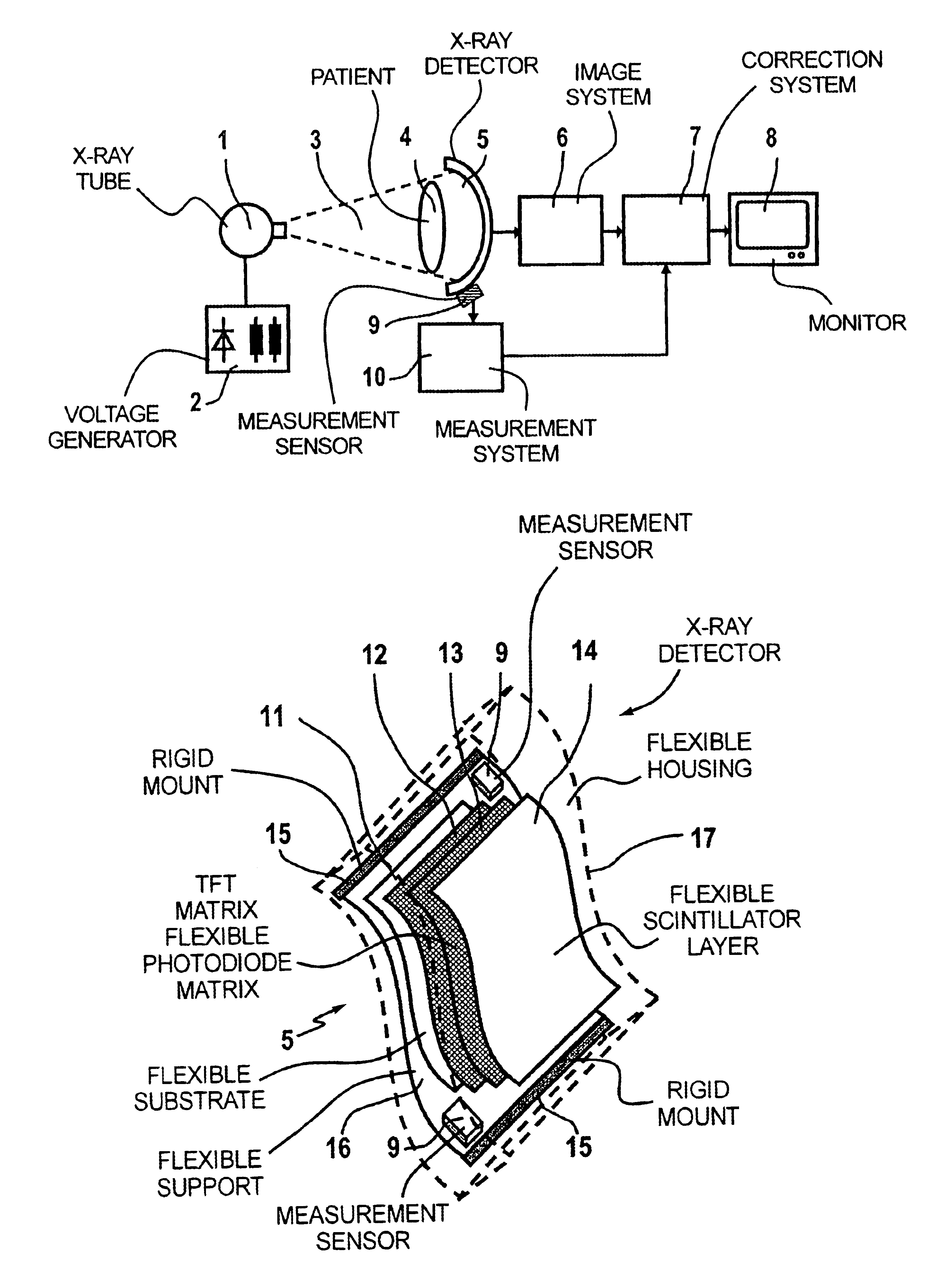 X-ray diagnostics installation with a flexible solid state X-ray detector