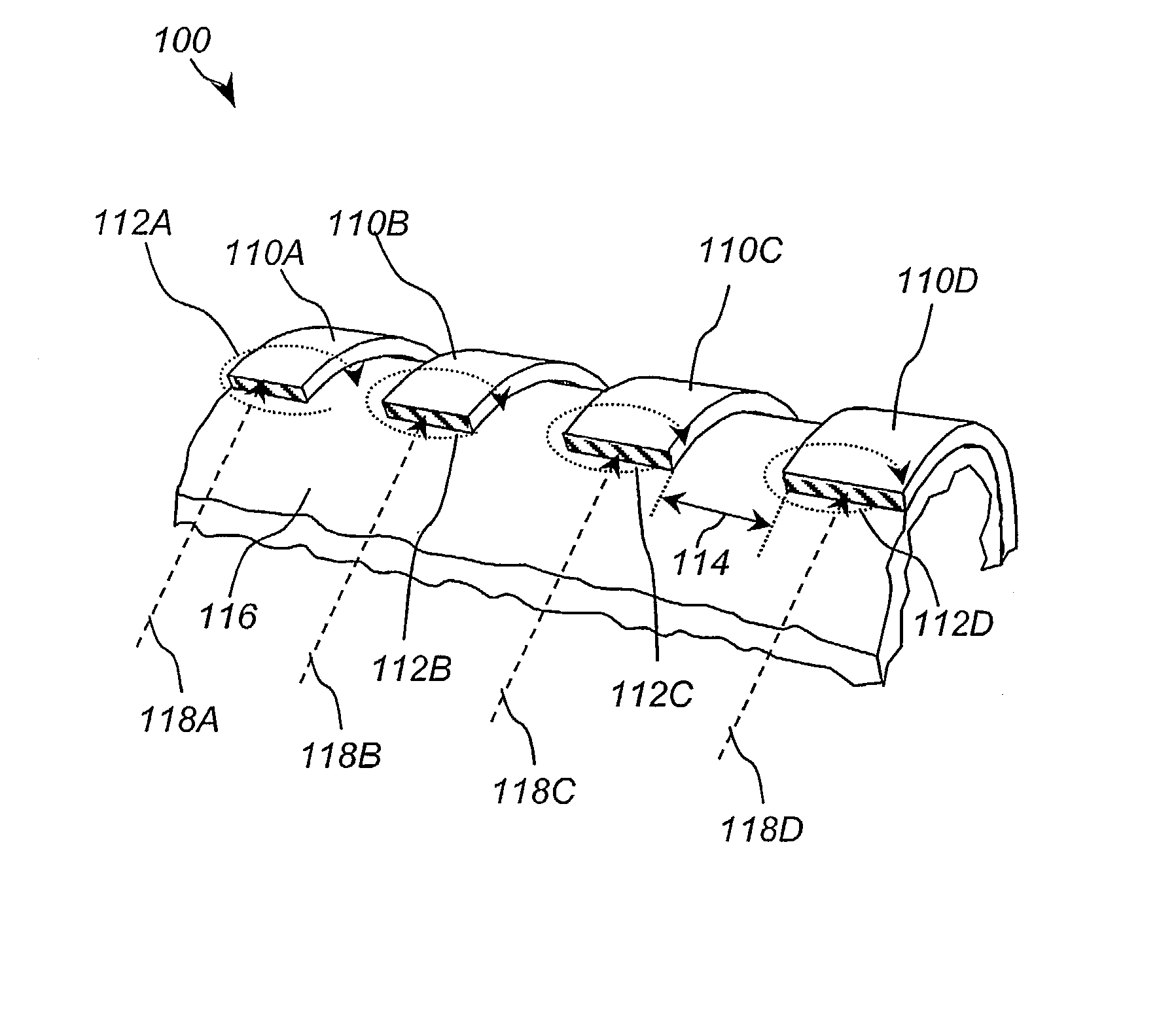 Low alternating current (ac) loss superconducting coils