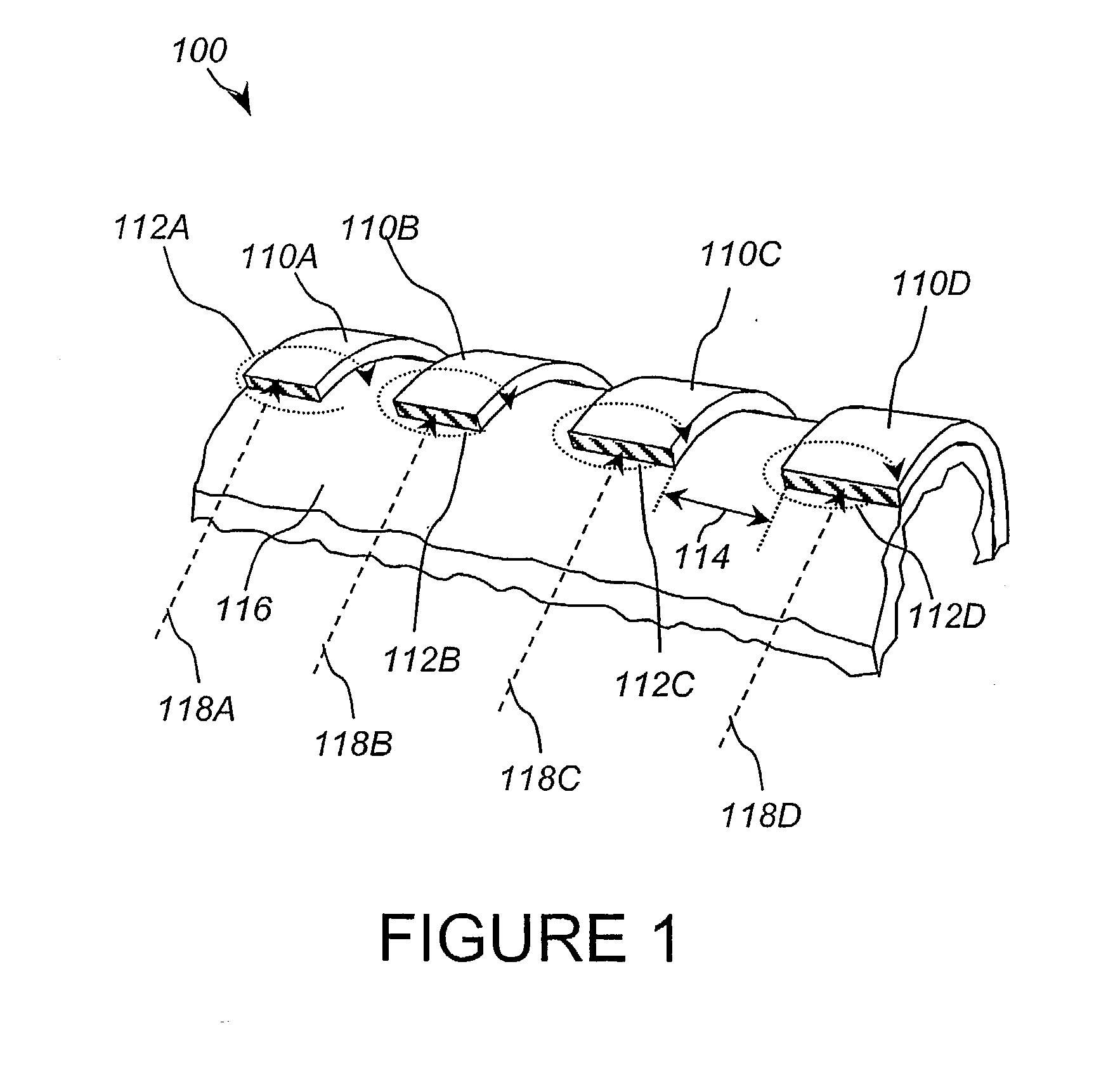 Low alternating current (ac) loss superconducting coils