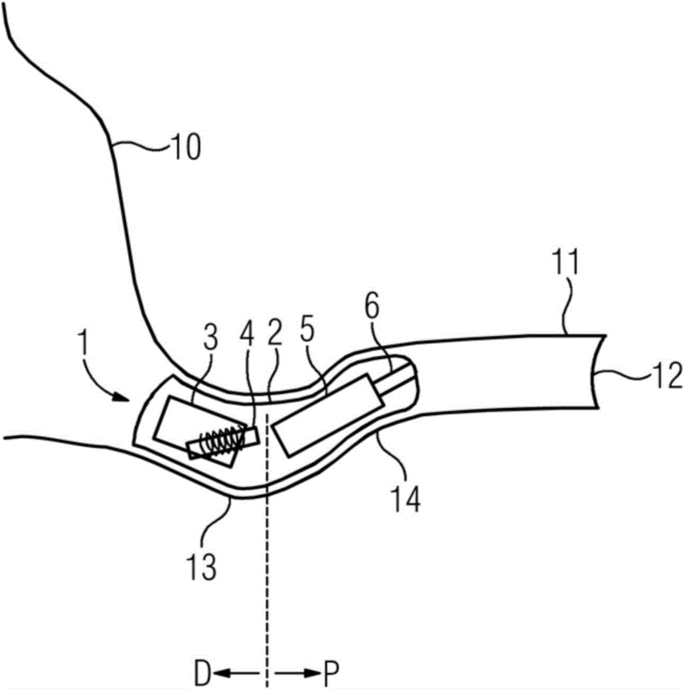 Binaural Hearing Instrument And Earpiece