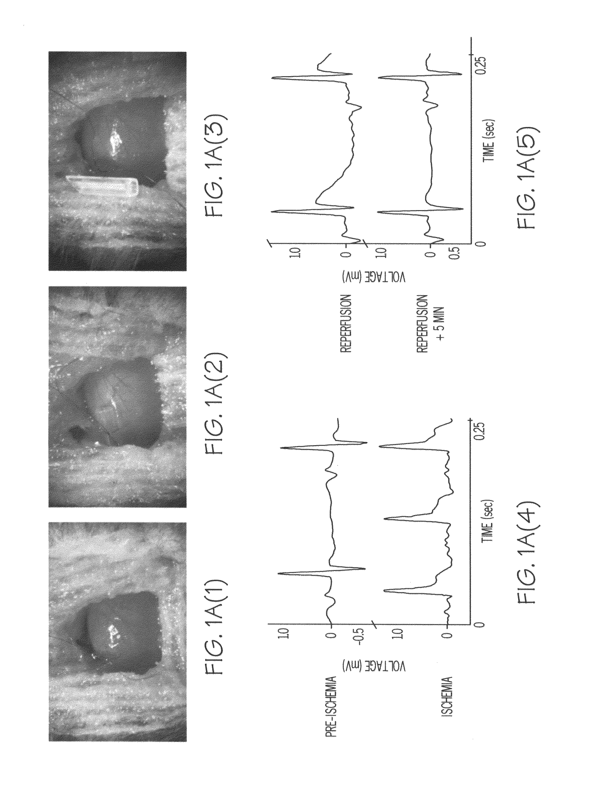 Methods of preventing ischemic injury using peripheral nociceptive stimulation