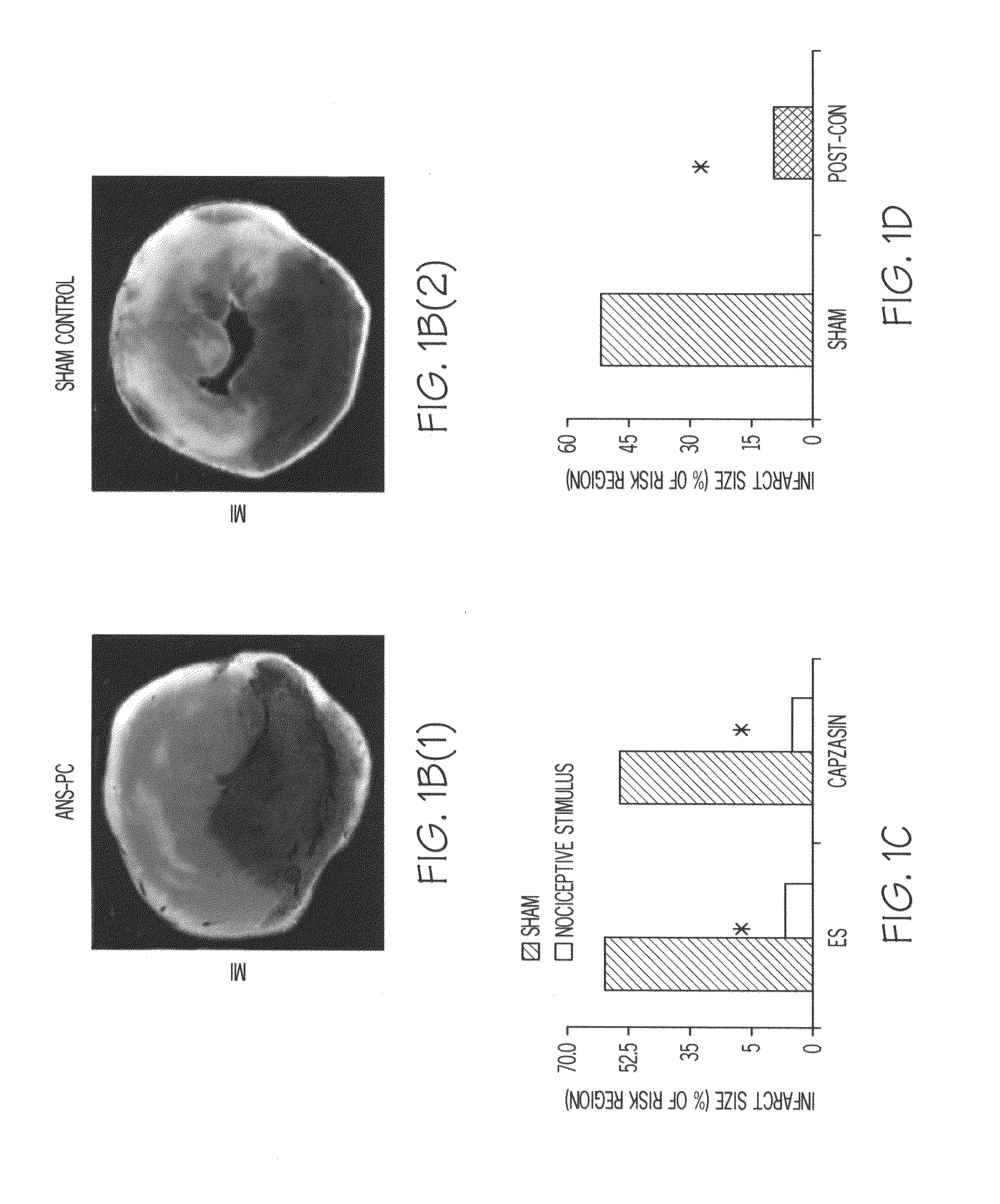 Methods of preventing ischemic injury using peripheral nociceptive stimulation