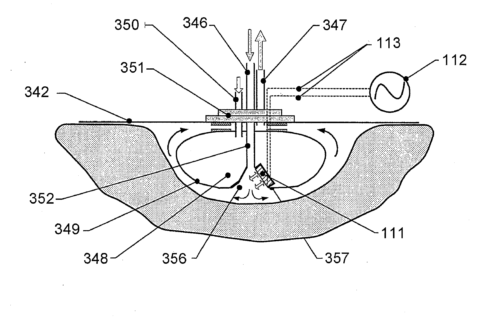 Wound treatment apparatus and method