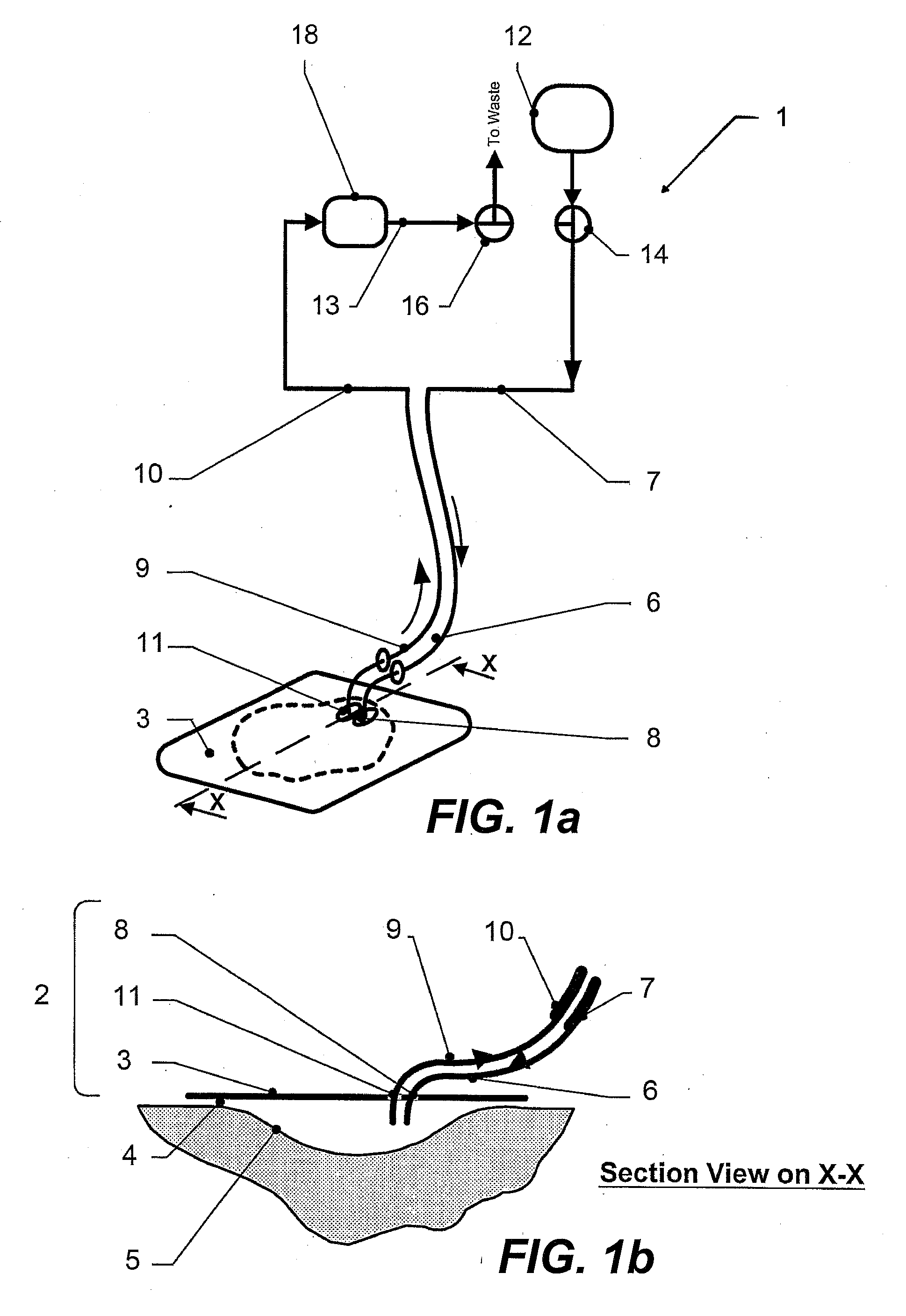 Wound treatment apparatus and method