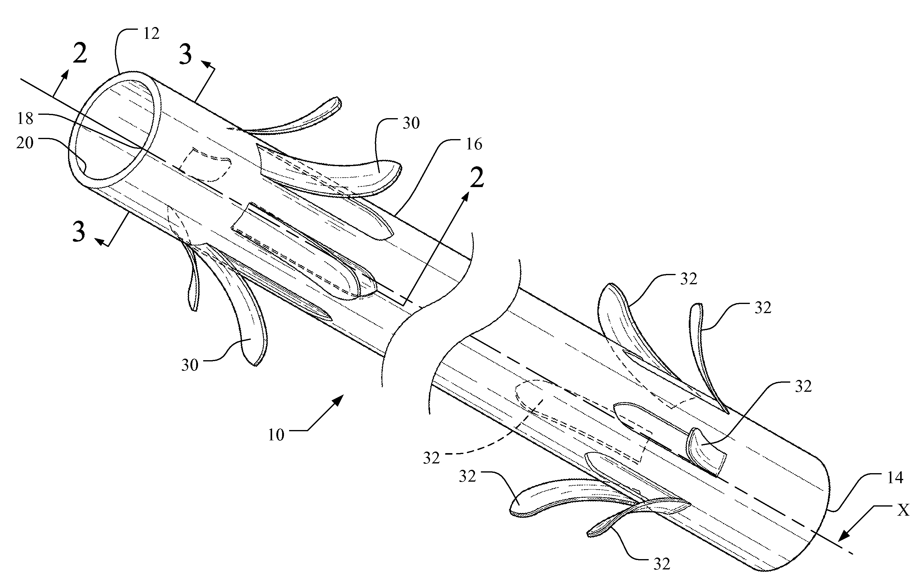 Medical implant having improved drug eluting features