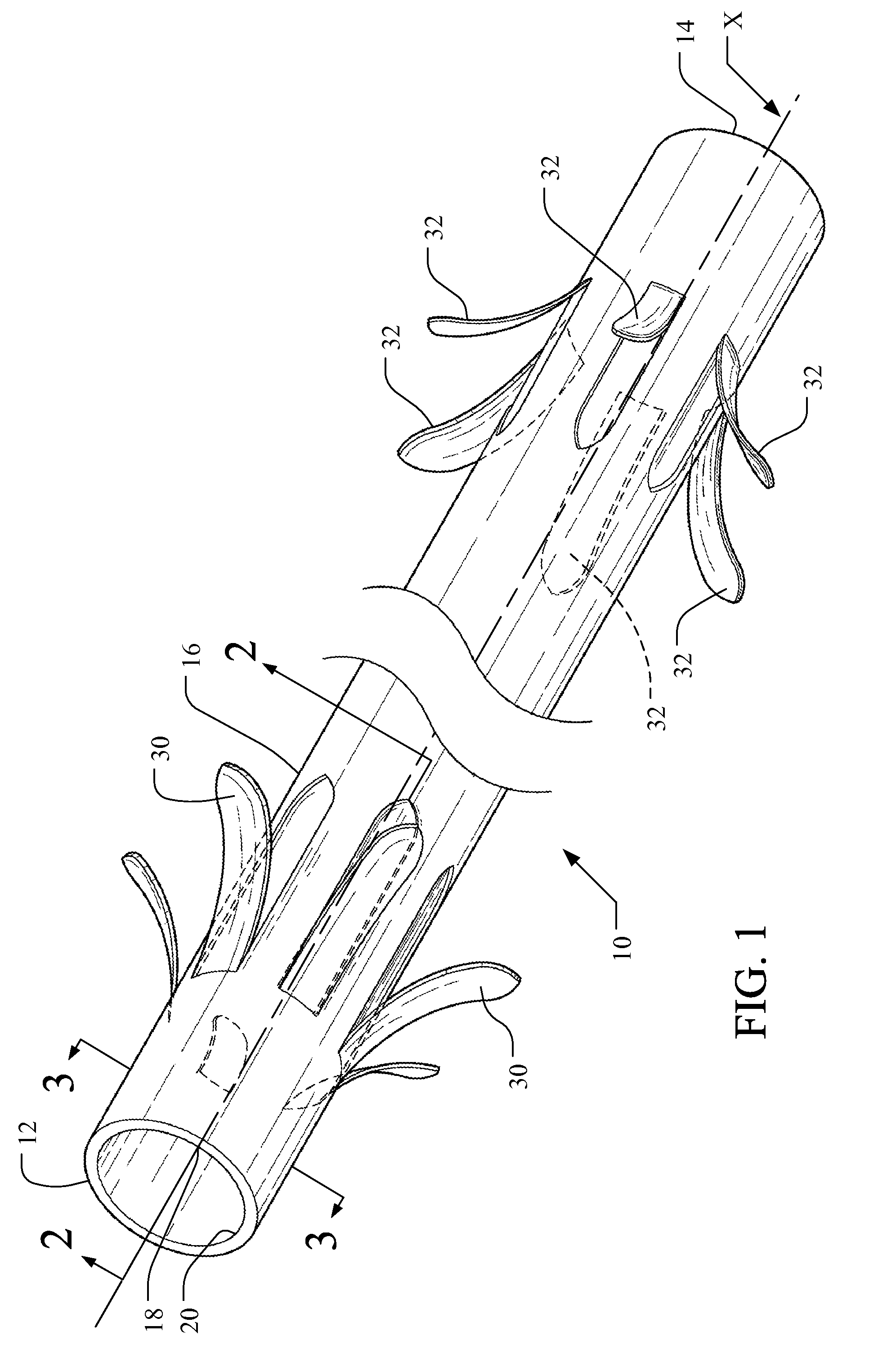 Medical implant having improved drug eluting features