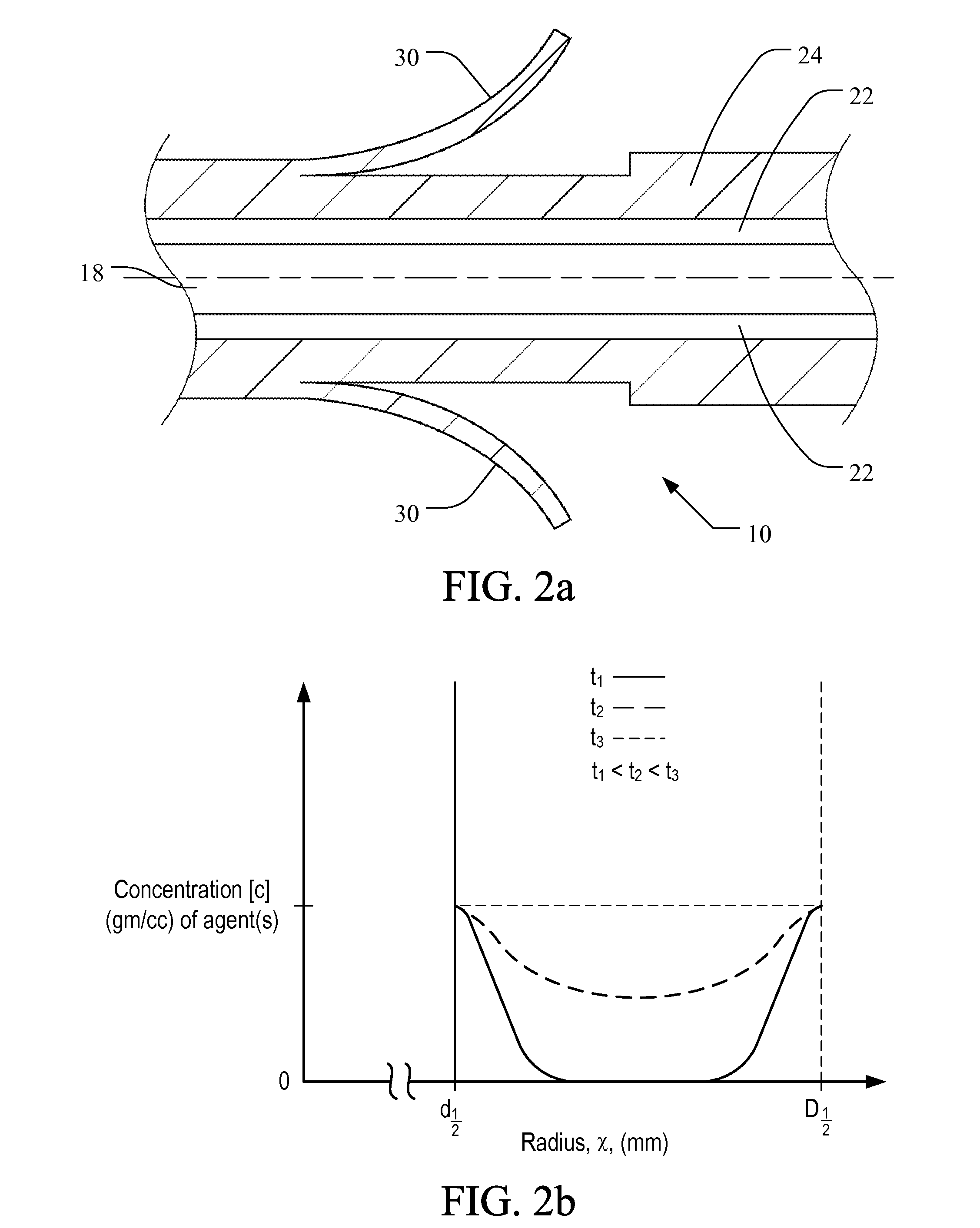 Medical implant having improved drug eluting features