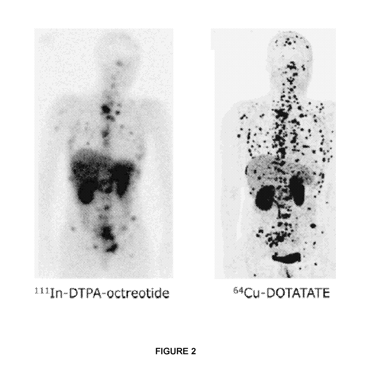 Pet tracer for imaging of neuroendocrine tumors