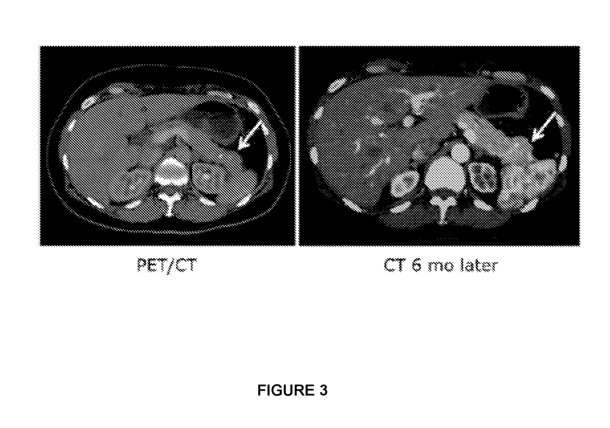 Pet tracer for imaging of neuroendocrine tumors