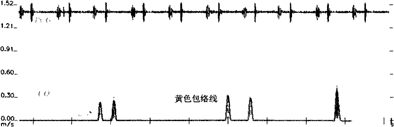 Method for recognizing ultrasonic spectrum enveloped peaks by combining cardiac sound