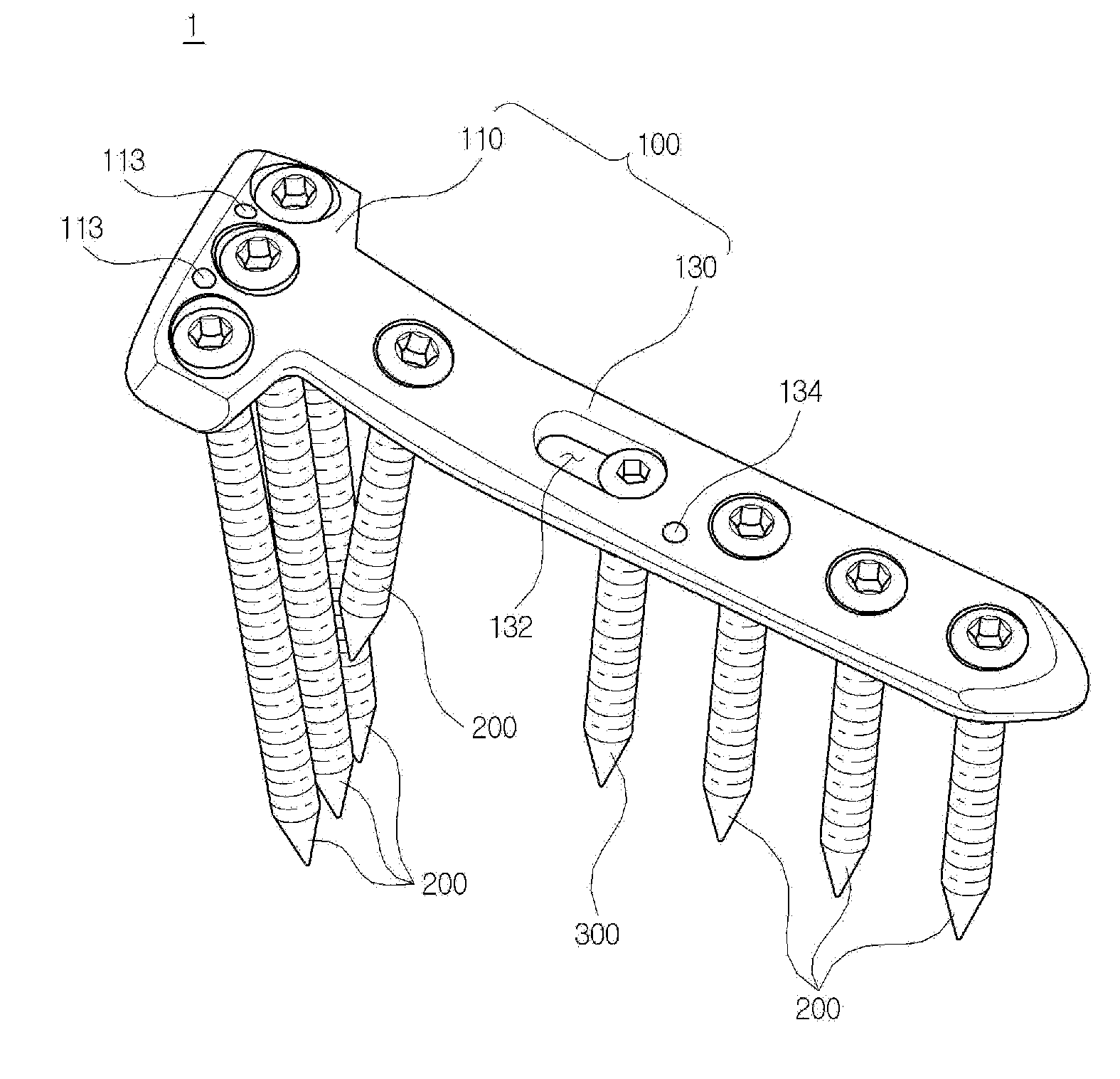 Fixing tool for open-wedge high tibial osteotomy