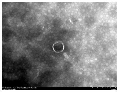 Escherichia coli bacteriophage composition and application thereof