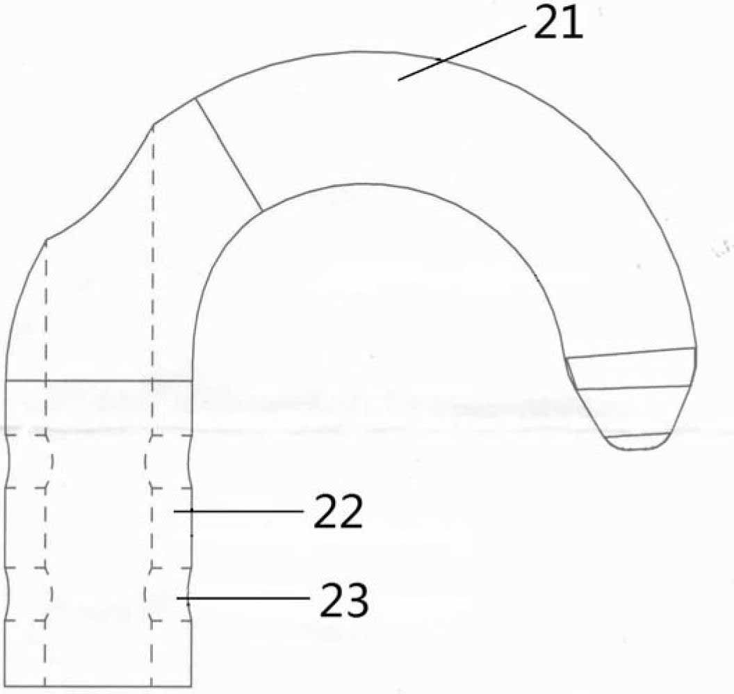 Coracoclavicular fixator