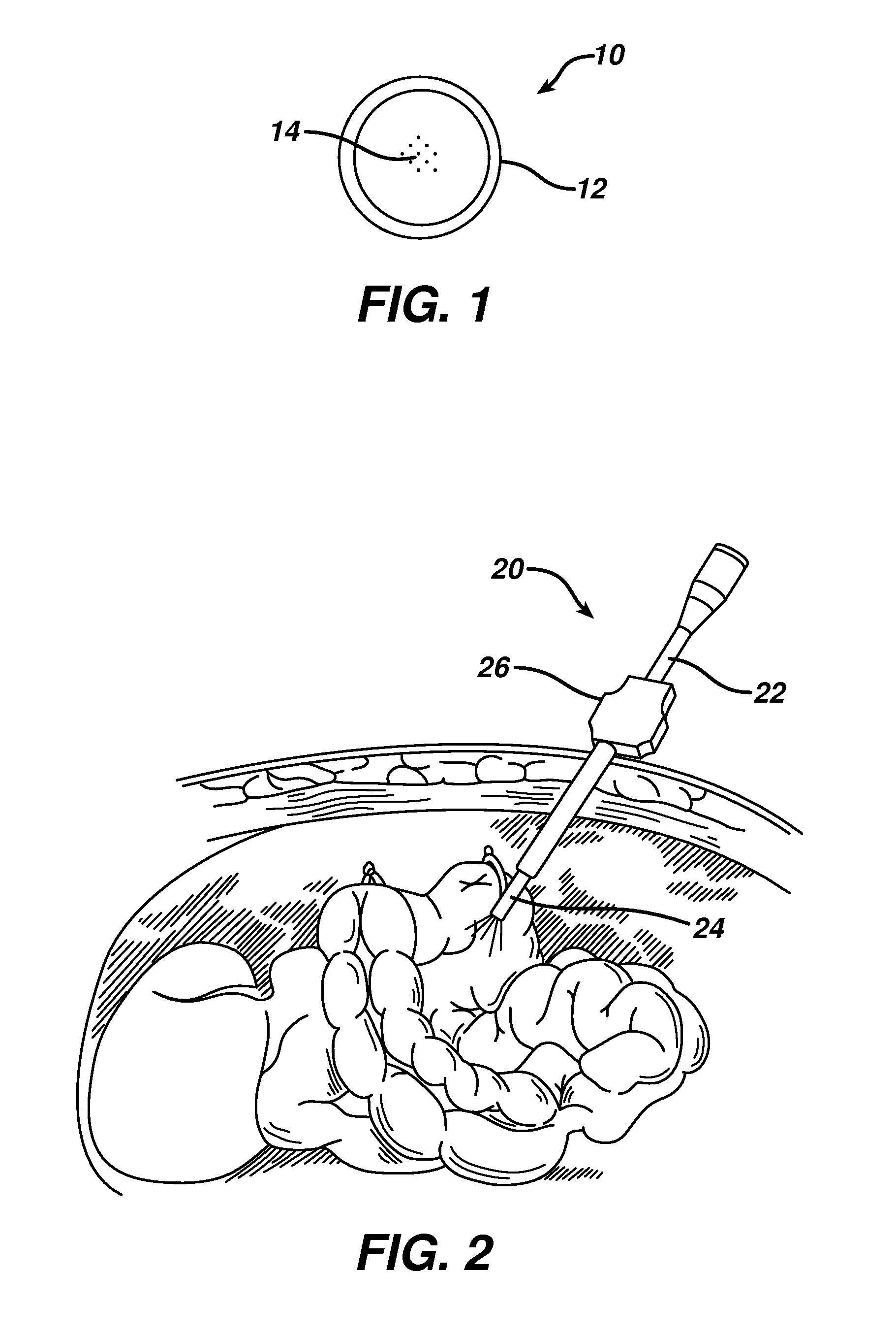 Nanoparticle treated medical devices