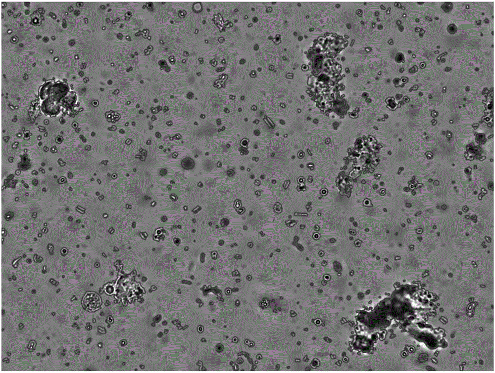 Method for classifying and identifying visible components of microscopic excrement examination images based on machine vision