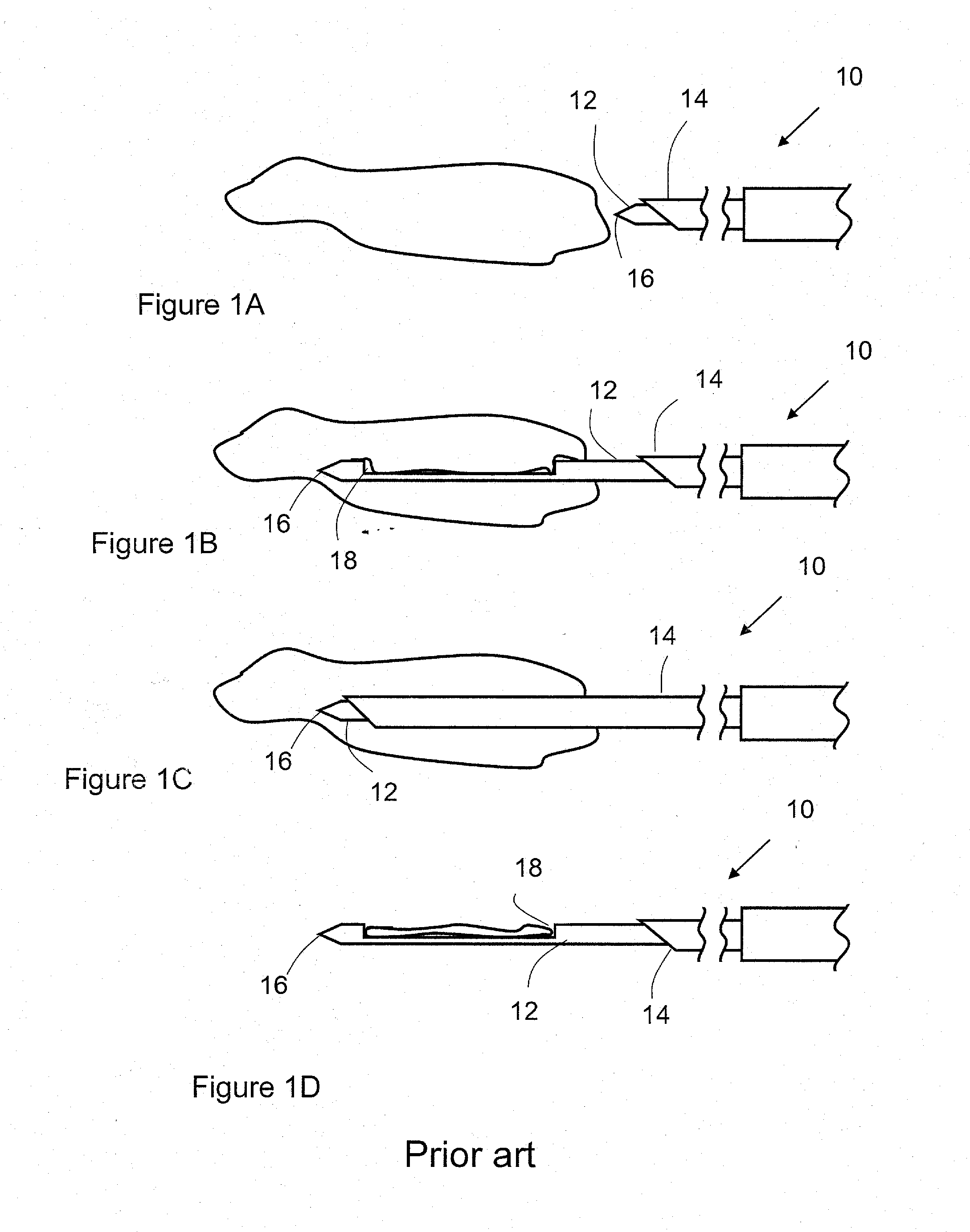 Device and method for handling biological tissues